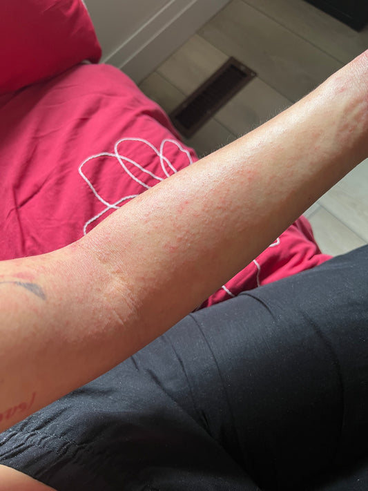 A Comprehensive Guide to Applying Body Butter on Damp Skin